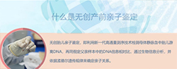 怀孕了岳阳怎么做孕期亲子鉴定,岳阳办理孕期亲子鉴定结果准吗 怀孕了岳阳怎么做孕期亲子鉴定,岳阳办理孕期亲子鉴定结果准吗